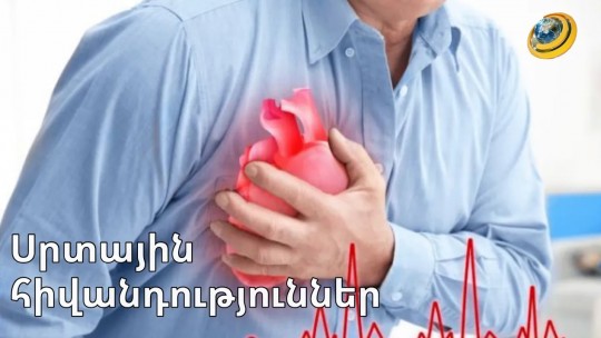 Որոնք են սրտային անբավարարության առաջացման պատճառները | Առողջություն և գեղեցկություն 17.05.2023